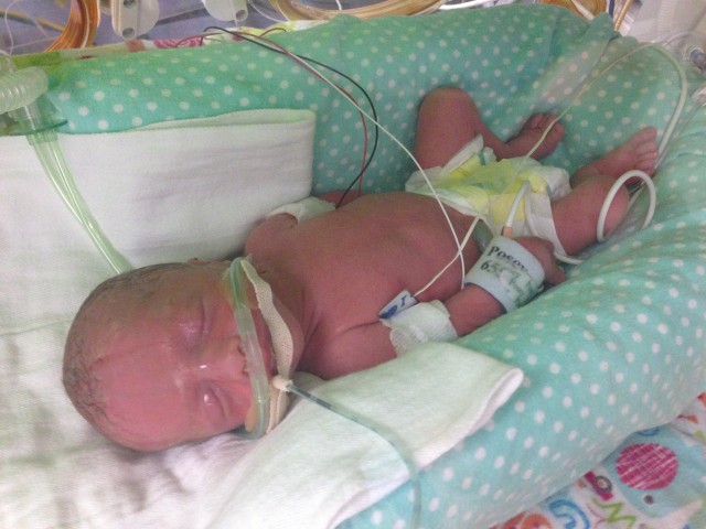 Ander. 3 pounds 14 ounces. 16 inches long. Born at 32 weeks--8 weeks before his due date.